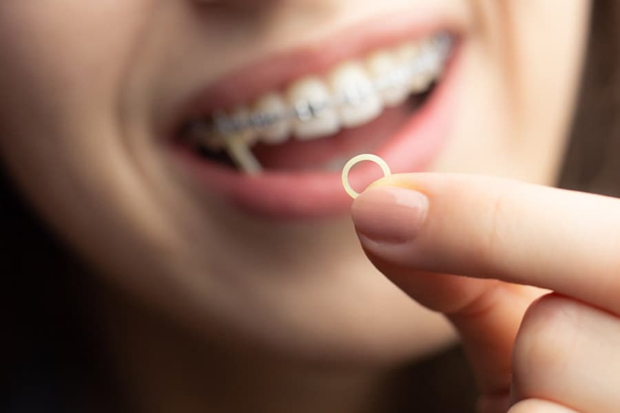Brackets zafiro en Oroso